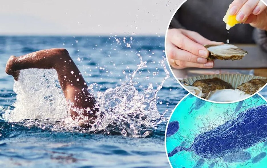 “flesh-eating bacteria”